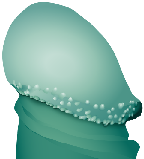 Darstellung Penis mit Hornzipfel - Illustration