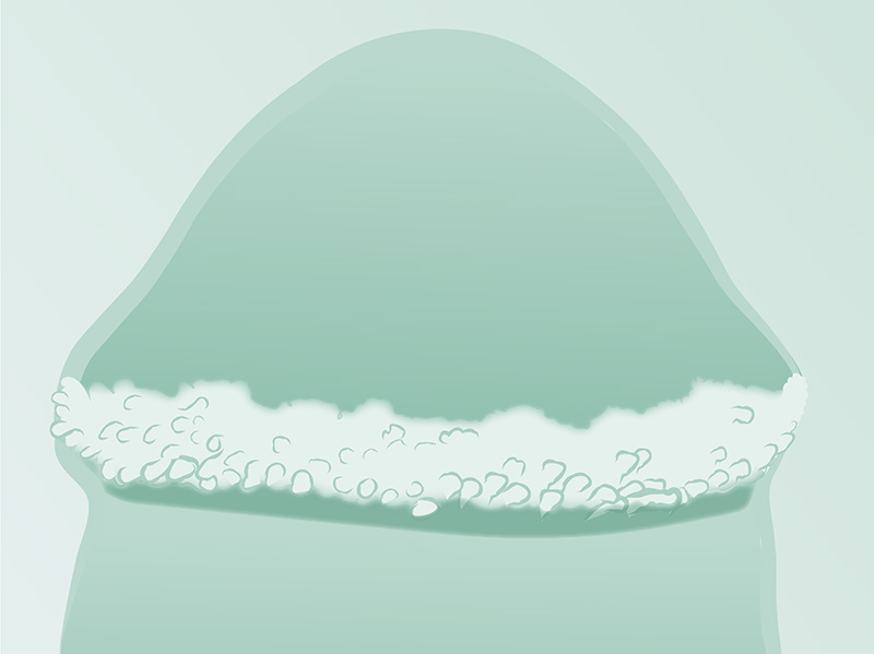 Darstellung Penis mit Hornzipfel direkt nach der Behandlung - Illustration